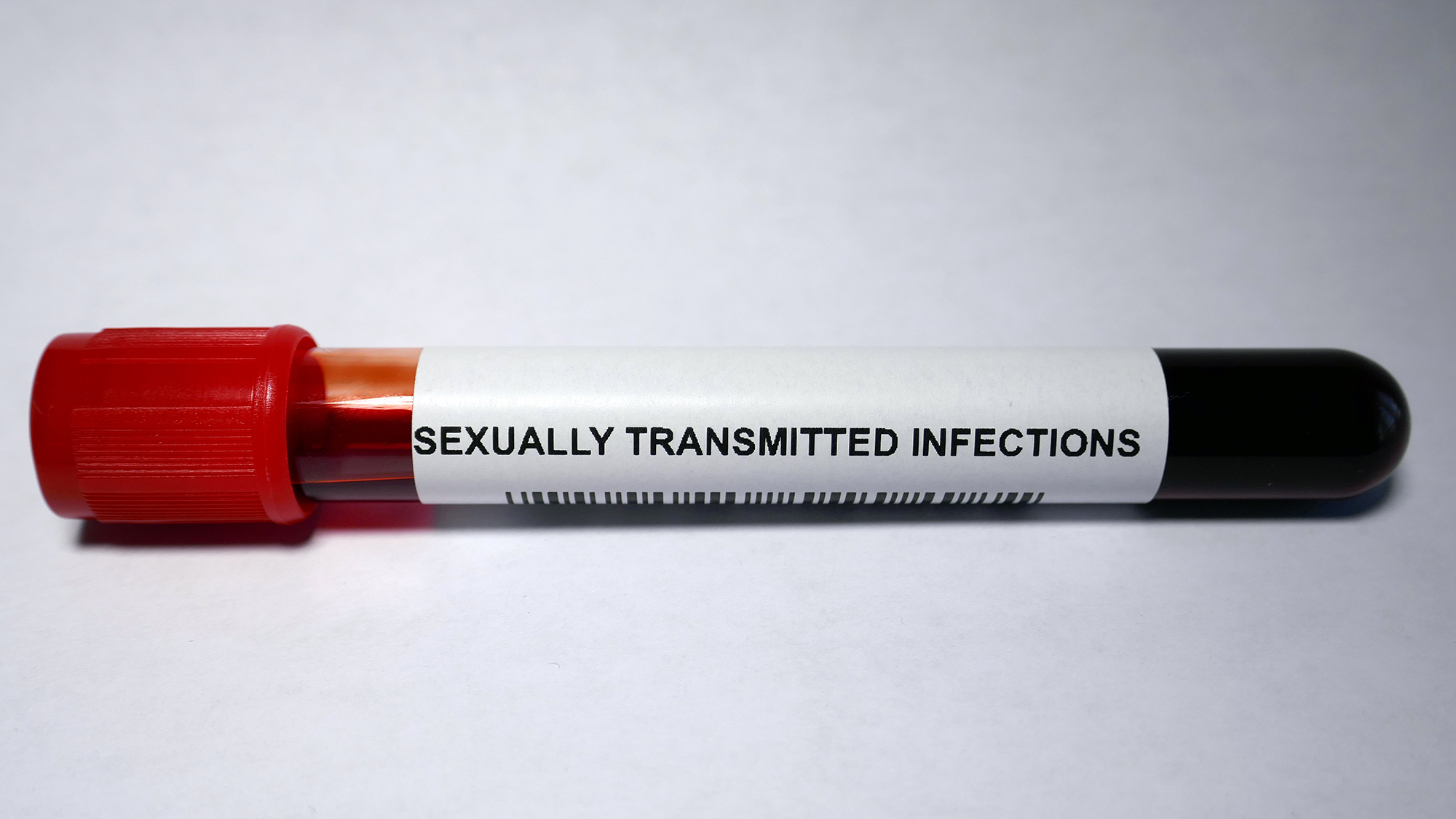 Blutprobe mit der Aufschrift "sexually transmitted infections"